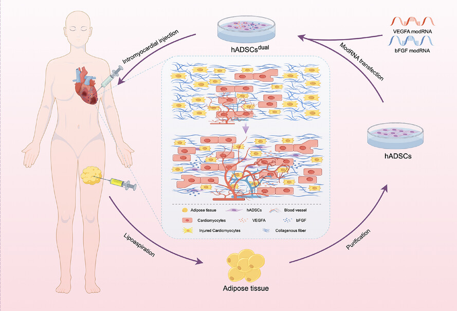 Enhanced human adipose-derived stem cells with VEGFA and bFGF mRNA promote stable vascular regeneration and improve cardiac function following myocardial infarction