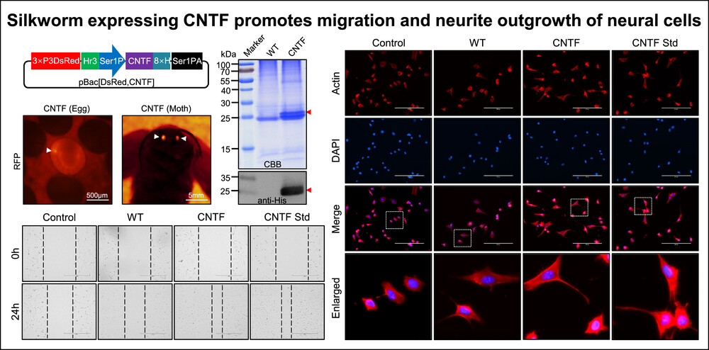 Transgenic silkworm expressing bioactive human ciliary neurotrophic factor for biomedical application