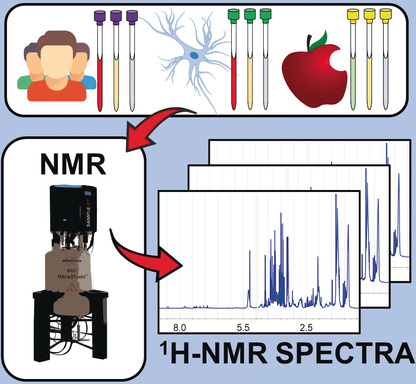 High-Throughput Metabolomics by 1D NMR