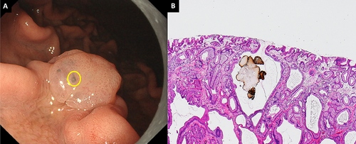 Details are in the caption following the image Details are in the caption following the image