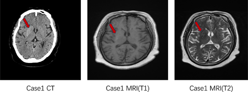 Details are in the caption following the image