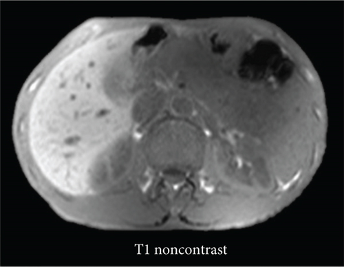 Details are in the caption following the image