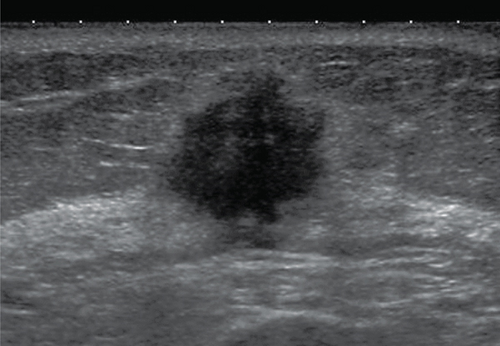Details are in the caption following the image