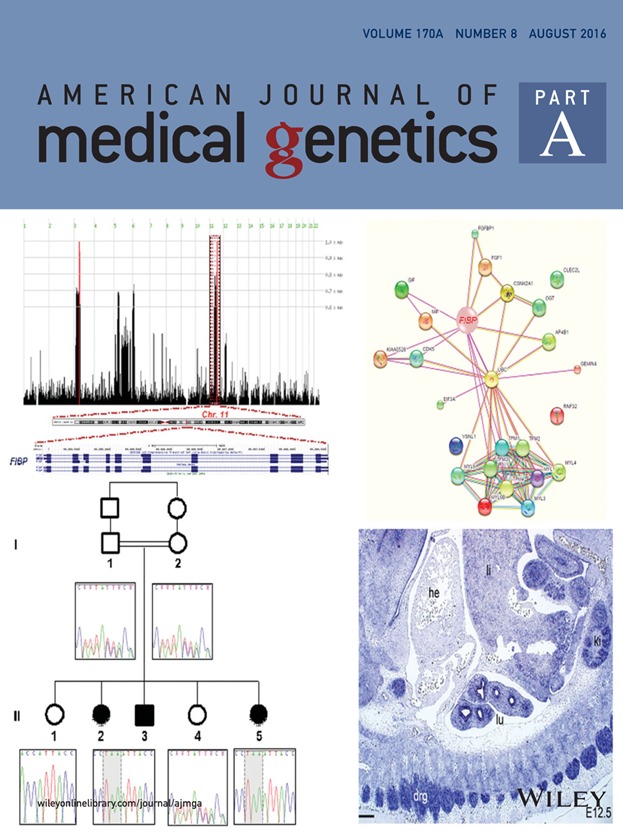 Cover Image, Volume 170A, Number 8, August 2016