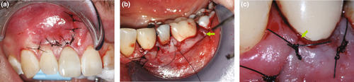 Details are in the caption following the image Details are in the caption following the image
