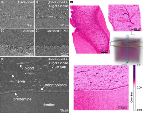 Details are in the caption following the image Details are in the caption following the image