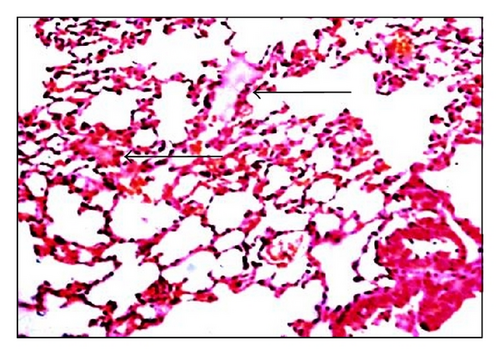 Details are in the caption following the image