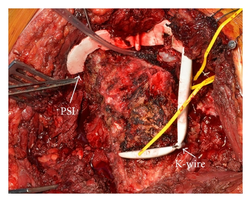 Details are in the caption following the image Details are in the caption following the image
