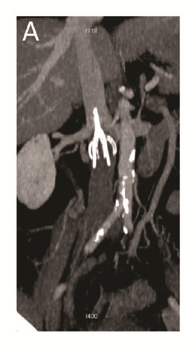 Details are in the caption following the image