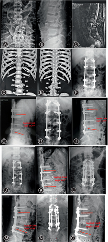 Details are in the caption following the image Details are in the caption following the image