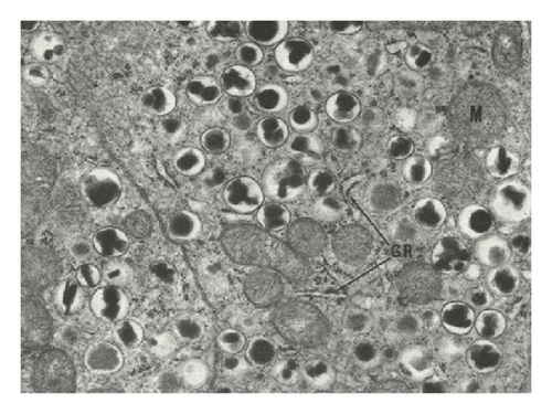 Details are in the caption following the image