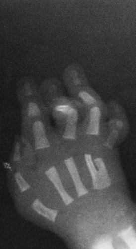 Details are in the caption following the image