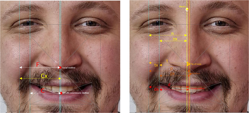 Details are in the caption following the image Details are in the caption following the image