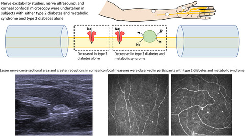 Impact of the metabolic syndrome on peripheral nerve structure and function in type 2 diabetes