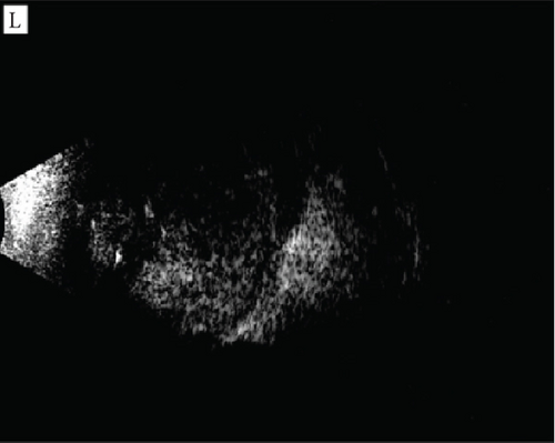 Details are in the caption following the image