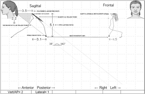 Details are in the caption following the image Details are in the caption following the image