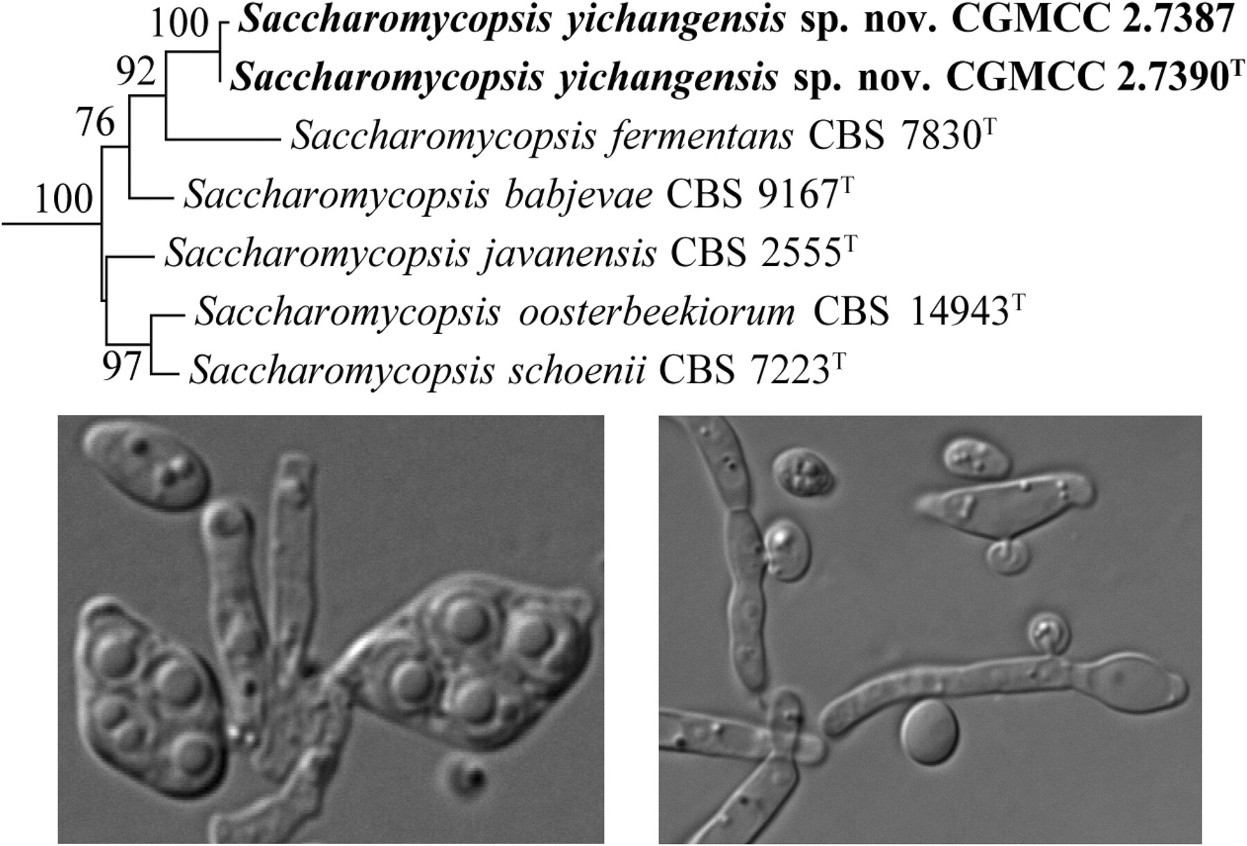 Saccharomycopsis yichangensis sp. nov., a Novel Predacious Yeast Species Isolated From Soil