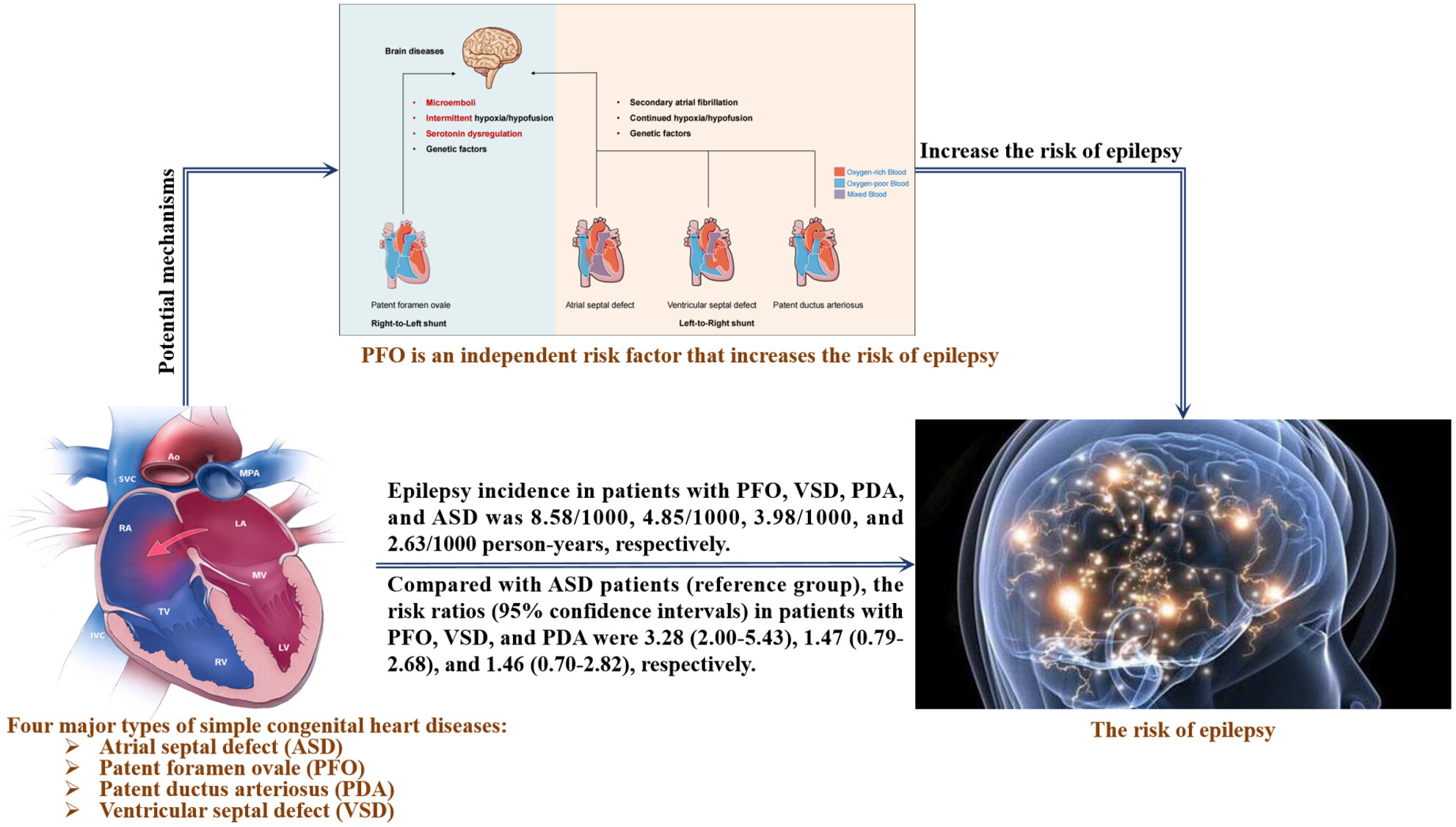 Comparing the Risk of Epilepsy in Patients With Simple Congenital Heart Diseases: A Prospective Cohort Study