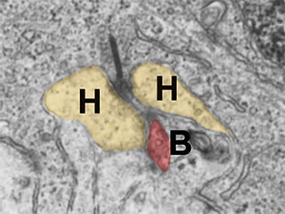 Development of cone photoreceptors and their synapses in the human and monkey fovea