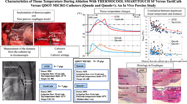 Characteristics of tissue temperature during ablation with THERMOCOOL SMARTTOUCH SF versus TactiCath versus QDOT MICRO catheters (Qmode and Qmode+): An in vivo porcine study