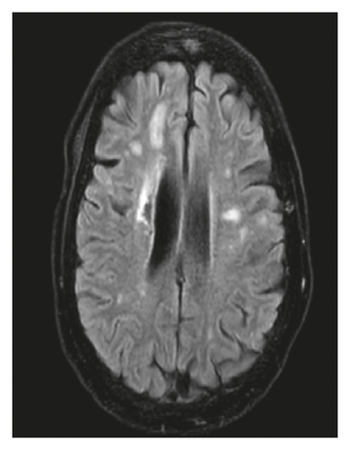 Details are in the caption following the image