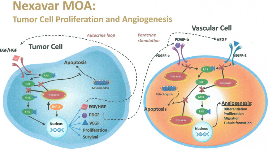 Pulmonary squamous cell carcinoma and sorafenib