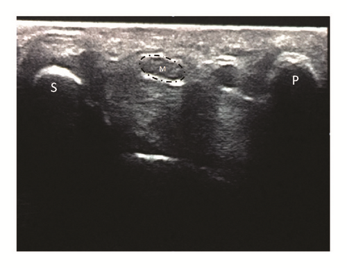 Details are in the caption following the image