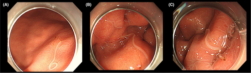 Details are in the caption following the image Details are in the caption following the image