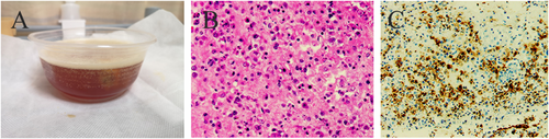 Details are in the caption following the image Details are in the caption following the image