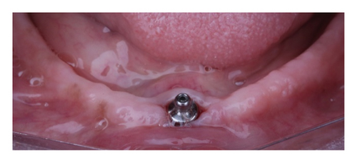 Details are in the caption following the image Details are in the caption following the image