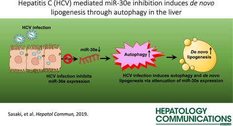 Repression of MicroRNA-30e by Hepatitis C Virus Enhances Fatty Acid Synthesis