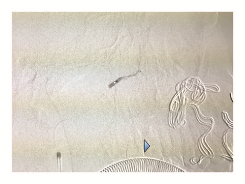 Details are in the caption following the image