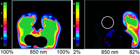 Digital diaphanoscopy of maxillary sinus pathologies supported by machine learning