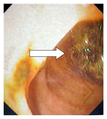 Details are in the caption following the image