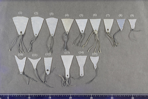 Efficacy of silicone sheet as a personalized barrier for preventing adhesion reformation after hysteroscopic adhesiolysis of intrauterine adhesions