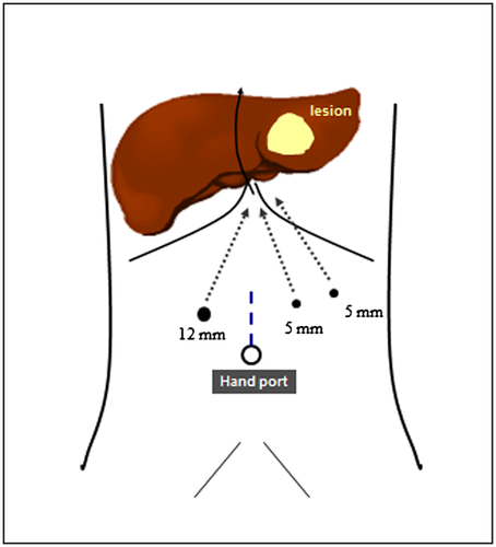 Details are in the caption following the image Details are in the caption following the image