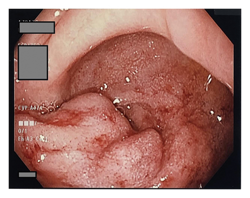 Details are in the caption following the image Details are in the caption following the image