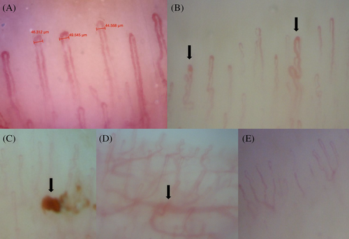 Details are in the caption following the image