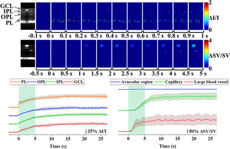 Functional optical coherence tomography of neurovascular coupling interactions in the retina