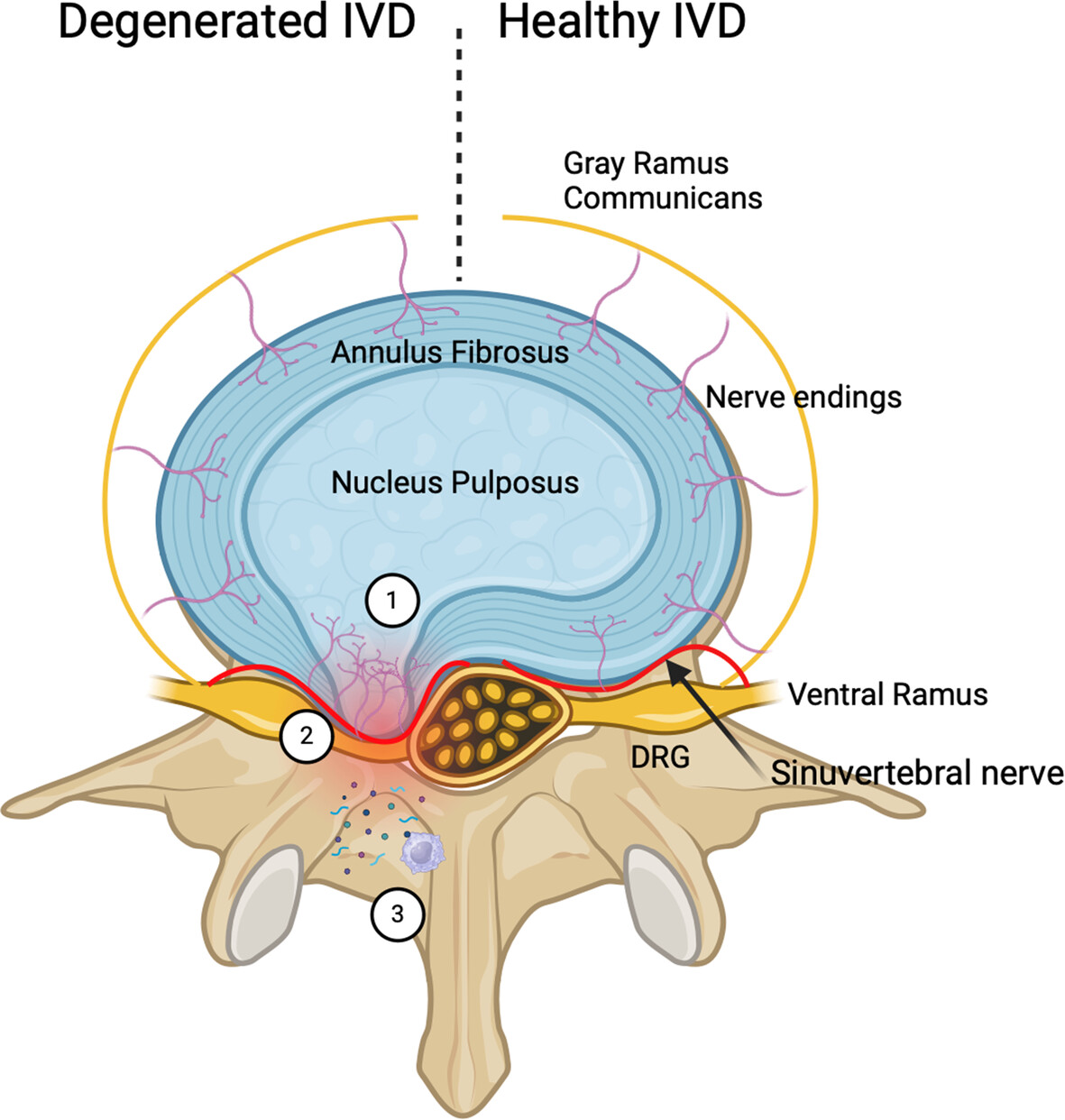 Contemporary clinical perspectives on chronic low back pain: The biology, mechanics, etc. underpinning clinical and radiological evaluation