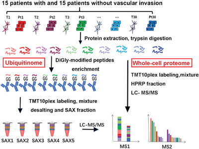 Integrative proteomics reveals the role of E3 ubiquitin ligase SYVN1 in hepatocellular carcinoma metastasis