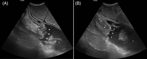 Details are in the caption following the image Details are in the caption following the image