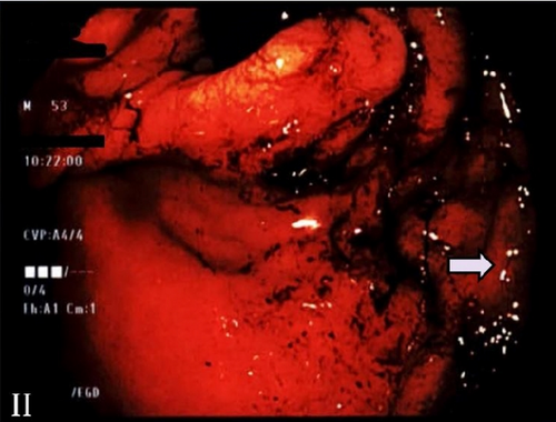 Details are in the caption following the image