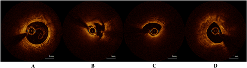 Details are in the caption following the image Details are in the caption following the image