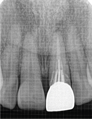Details are in the caption following the image