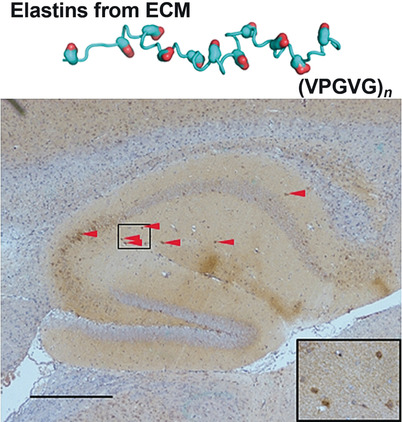 Significant Upregulation of Alzheimer's β-Amyloid Levels in a Living System Induced by Extracellular Elastin Polypeptides