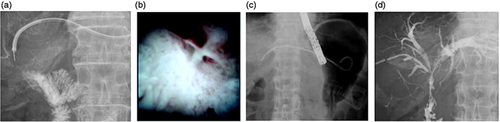 Details are in the caption following the image Details are in the caption following the image