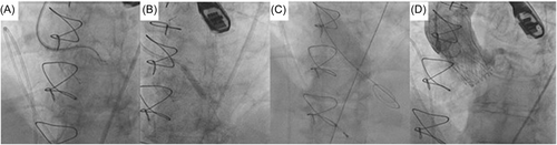 Details are in the caption following the image Details are in the caption following the image