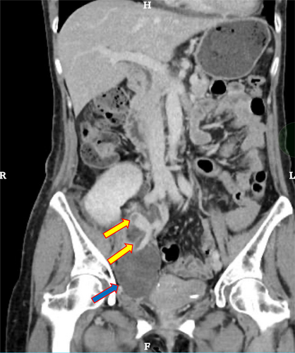 Details are in the caption following the image Details are in the caption following the image
