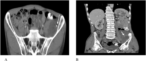 Details are in the caption following the image Details are in the caption following the image